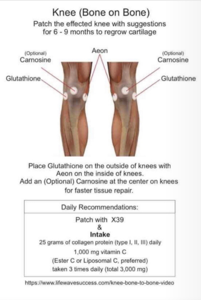 The following is a visual strategy to use Life Wave Patches to reverse bone on bone knee pain and regrow cartilage in the knee joint